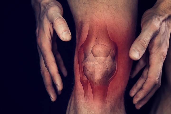 10 dicas para evitar lesões desportivas nos joelhos
